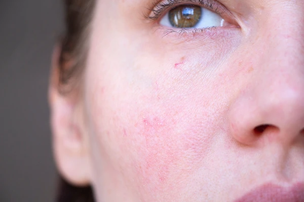 hisensitive-crema-nutritiva-MODO-EMPLEO